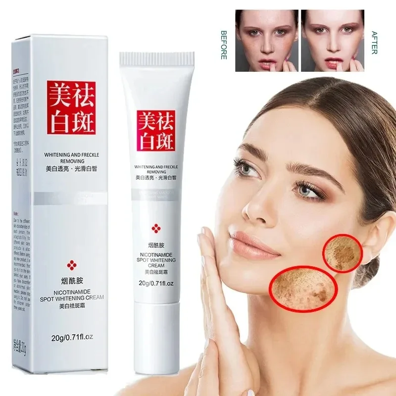 Skincare Niacinamide - Crema facial que se desvanece, pecas,