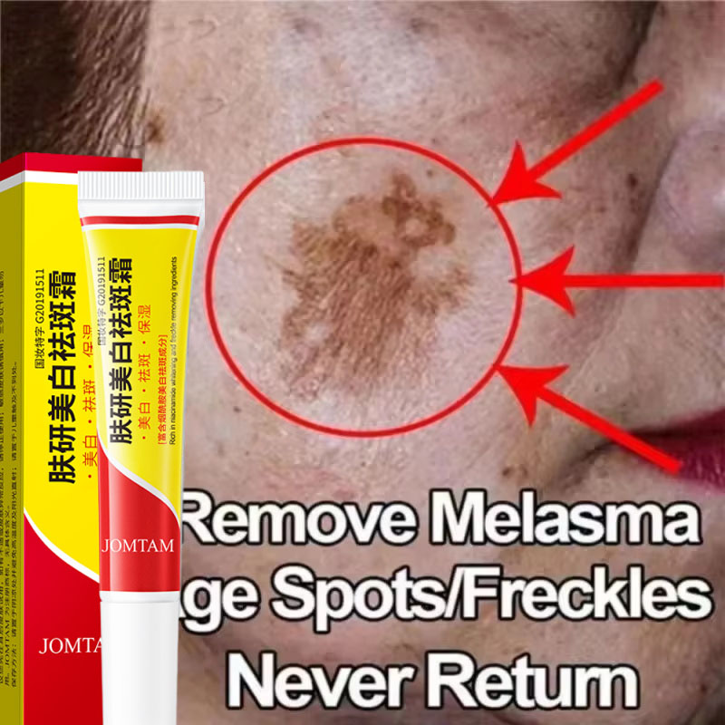 Skincare Niacinamide - Crema Blanqueadora para el Rostro, Crema