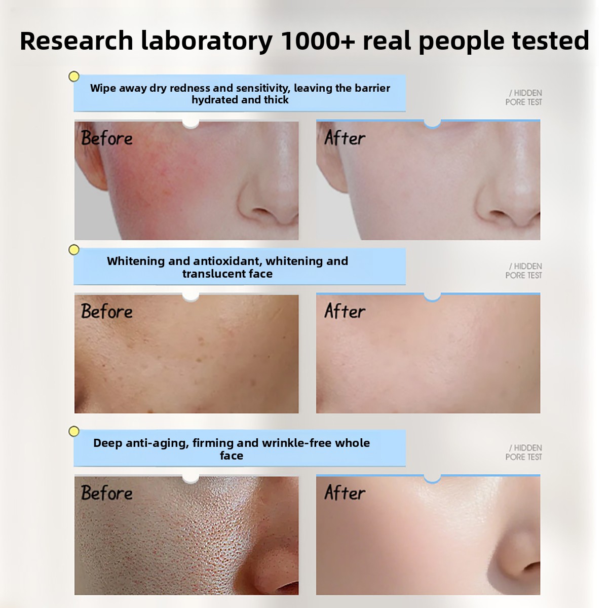 Crema Facial Ruyi con Vitamina - Skincare Niacinamide reseña y precio