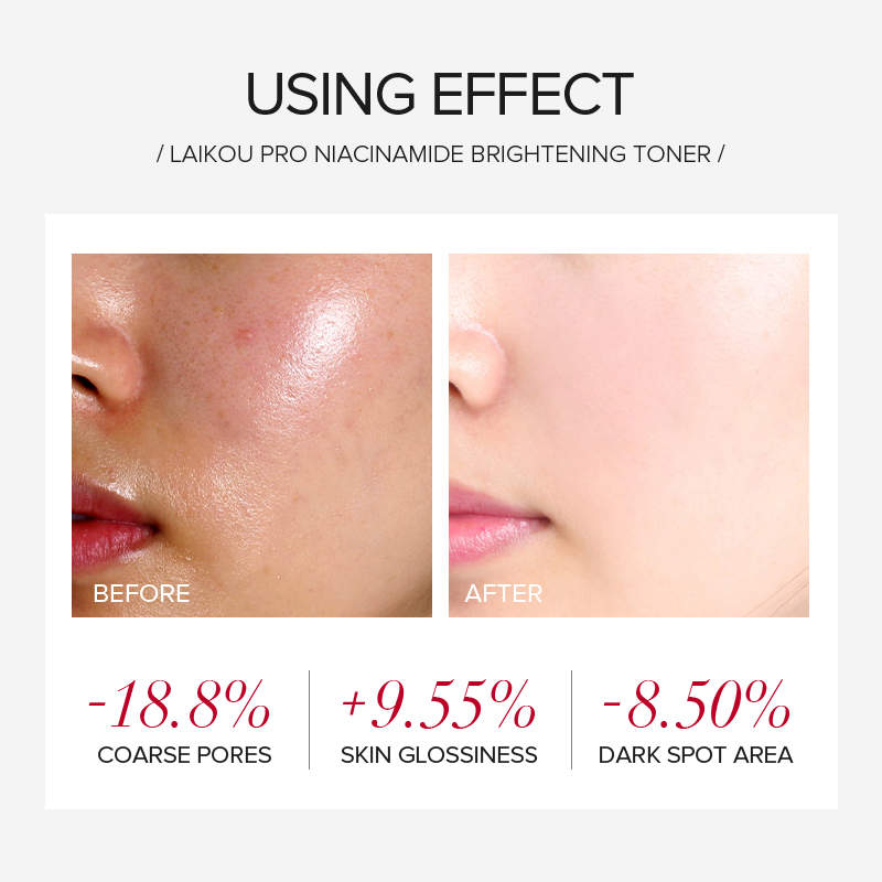 LAIKOU PRO Niacinamida, Set de - Skincare Niacinamide reseña y precio