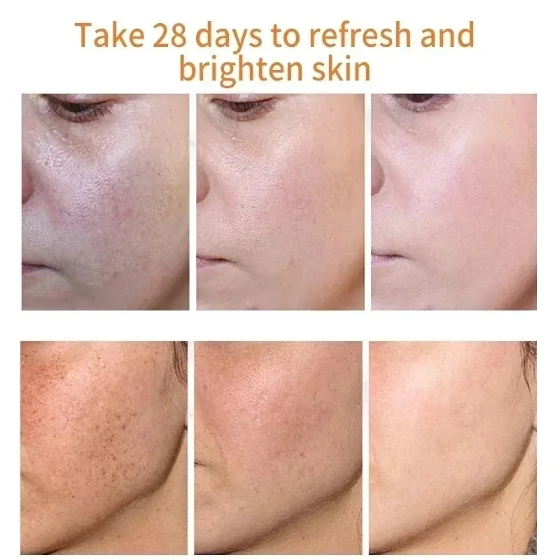 Crema facial que se desvanece, - Skincare Niacinamide reseña y precio
